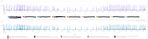 first chart: counting all messages of loglevel warn per Host; second chart: count all  messages of warning  grouped by the java class