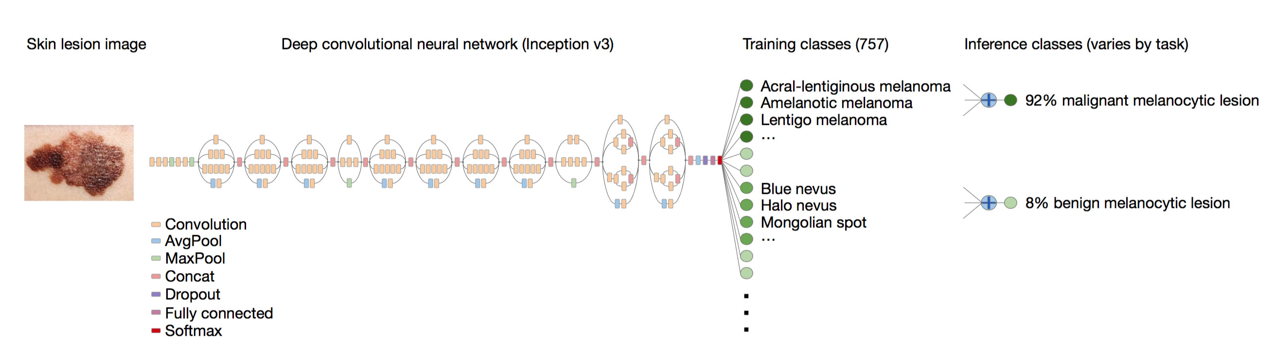 Переводчик нейросеть deep. Сегментация раковых опухолей нейросети. Concat two Neural Network.